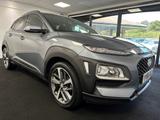 Hyundai KONA Photo 2